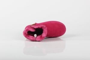 Mini Bailey Button II